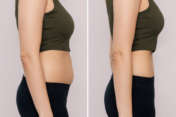 Lipo-Plus Injections - Express Weight Loss and Wellness